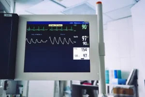 Ekg